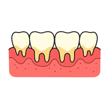 Gum treatment Springboro OH