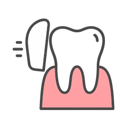 Digital imaging preview of smile design with veneers